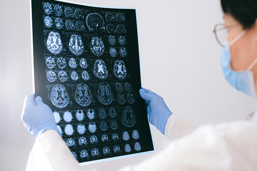 Fevereiro Roxo: Mês de Conscientização para Lúpus, Alzheimer e Fibromialgia